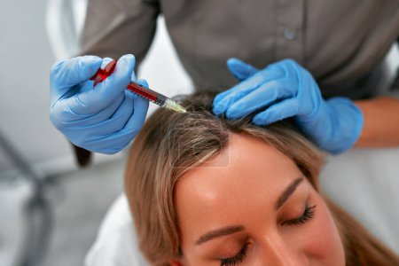 Photo for Mesotherapy, vitamin injections in head skin of hair area. Professional hair loss treatment. Close up view of woman head and doctor's hands with syringe. - Royalty Free Image