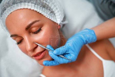 Foto de Una joven se limpia la cara en el consultorio de un cosmetólogo. Limpieza de la piel en el salón de belleza. Esteticista exprimiendo granos y puntos negros de la cara. - Imagen libre de derechos