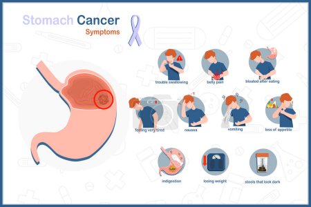 Illustration for Flat medical vector illustration of stomach cancer.Symptoms of stomach cancer.trouble swallowing,belly pain, bloated,indigestion,nausea and vomiting,loss of appetite,losing weight, and black stools. - Royalty Free Image