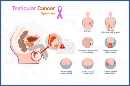 Illustration for Medical vector illustration concept in flat style of testicular cancer. Symptoms of testicular cancer include back pain, discomfort in testicular, swelling in a scrotum, lump in either testicle. - Royalty Free Image