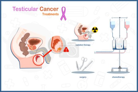 Illustration for Testicular cancer treatment. Medical illustration vector concept in flat style of testicular cancer treatment includes surgery,chemotherapy and radiation therapy. - Royalty Free Image