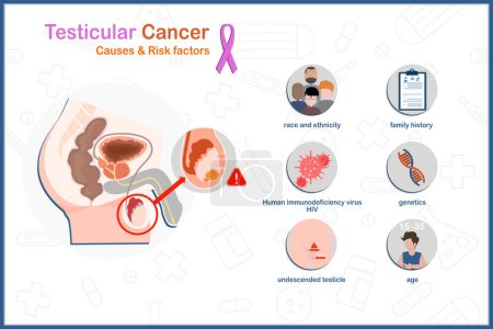 Illustration for Medical illustration vector concept in flat style of testicular cancer causes and risk factors.family history,age,race and ethnicity,HIV infection,genetic and undescended testicle. - Royalty Free Image