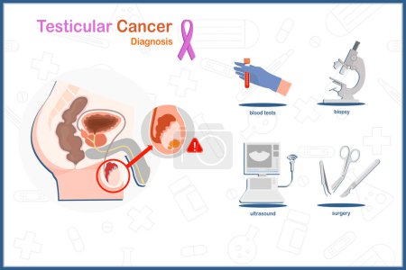 Illustration for Vector illustration in health care and medical concept.Diagnosis of testicular cancer such as biopsy,blood tests,ultrasound and surgery. - Royalty Free Image