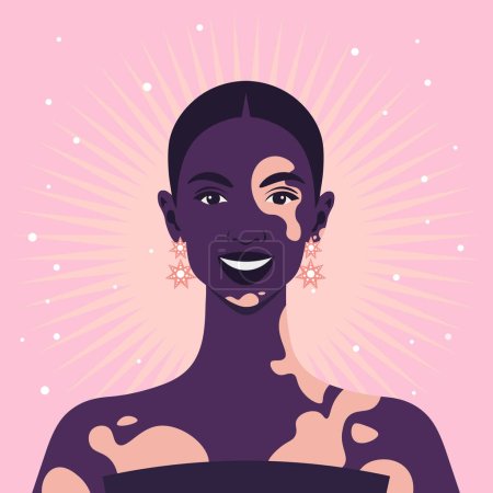 Téléchargez les illustrations : Le visage d'une femme africaine heureuse avec dépigmentation de vitiligo sur un fond rose. Illustration à plat vectoriel - en licence libre de droit