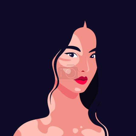 Téléchargez les illustrations : Le visage d'une jeune femme asiatique est à moitié tourné avec dépigmentation vitiligo sur un fond sombre. Portrait de modèle de mode. Illustration à plat vectoriel - en licence libre de droit