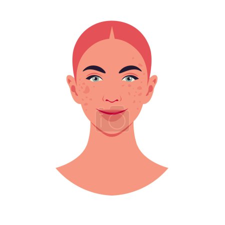 Ilustración de La cara de una joven pelirroja con pigmentación de la piel sobre un fondo blanco. Dermatología y cosmetología. Ilustración plana del vector - Imagen libre de derechos