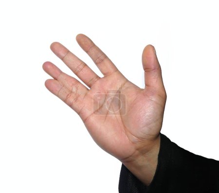 Téléchargez les photos : Une main ouverte isolée sur un fond blanc, présente une difformité congénitale appelée syndactylie, où deux doigts sont reliés par la peau - en image libre de droit