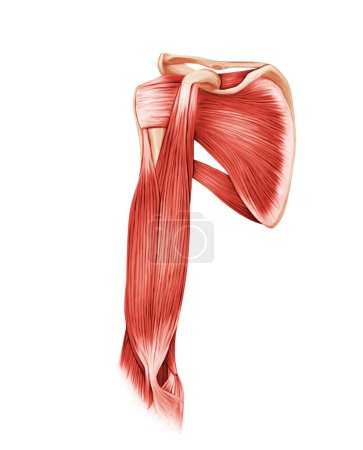 Liberación artroscópica Músculo del hombro congelado