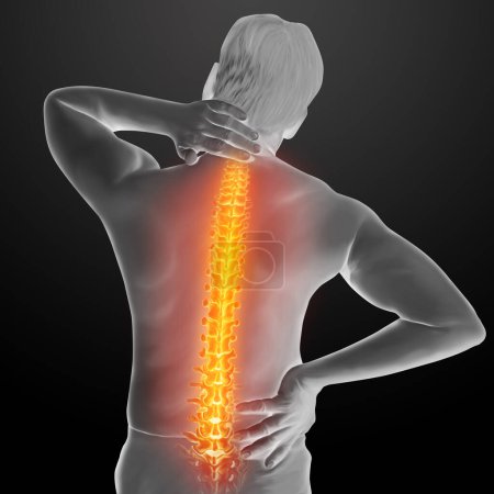 Illustration médicale d'anatomie de douleur dorsale humaine