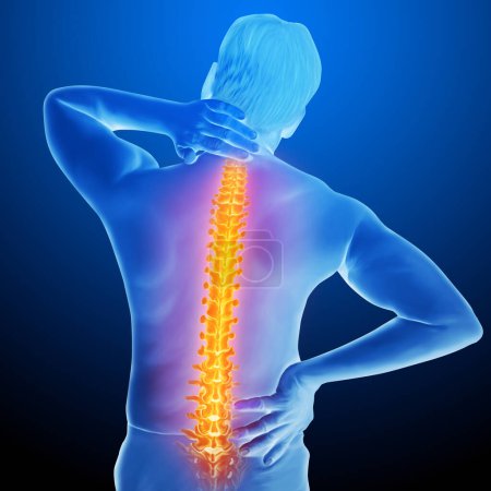 Téléchargez les photos : Illustration médicale d'anatomie de douleur dorsale humaine - en image libre de droit