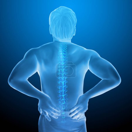 Illustration médicale d'anatomie de douleur dorsale humaine