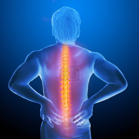Foto de Dolor de espalda humana Anatomía médica Ilustración - Imagen libre de derechos