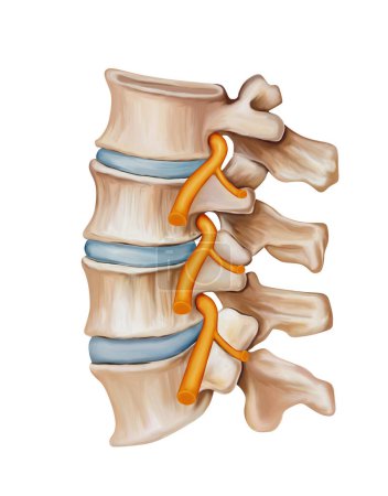Espina dorsal - Irritación del nervio espinal Ilustración médica