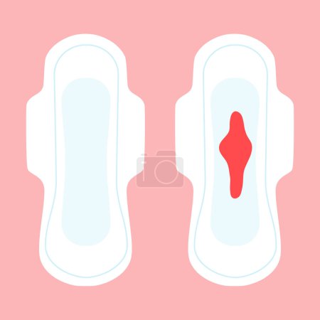 Weibliche Hygiene. Große Menstruationspolster für die Blutspende. Kritische Tage für Frauen. Menstruation Hygienepolster. Vektorillustration