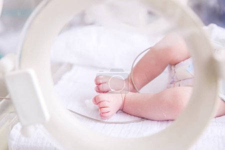 Newborn baby boy covered in vertix inside incubator 