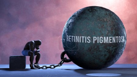 Foto de Retinitis pigmentosa - una metáfora que muestra la lucha humana con la Retinitis pigmentosa. Persona resignada y exhausta encadenada a Retinitis pigmentosa. Deprimido por una lucha continua - Imagen libre de derechos
