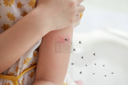 Photo for Little girl has skin rash allergy and itchy on her arm from mosquito bite - Royalty Free Image