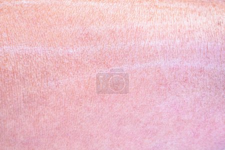 Photo for Dry and dehydrated human skin texture background - Royalty Free Image