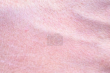 dry and dehydrated human skin texture background