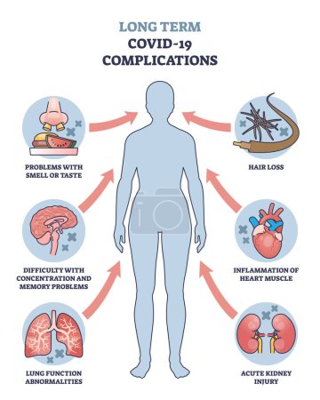 Ilustración de Las complicaciones a largo plazo de COVID 19 con síntomas médicos delinean el diagrama. Esquema educativo etiquetado con problemas de salud después de la ilustración del vector de la enfermedad viral. Signos de olfato, sabor e inflamación. - Imagen libre de derechos