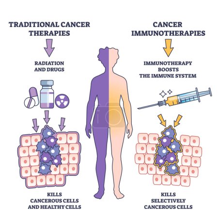 Immunotherapy method for cancer treatment for immune system outline diagram. Labeled educational scheme as medical therapy for oncology illness vector illustration. Kills selectively cancerous cells.