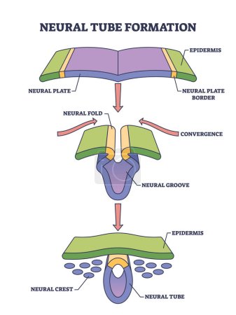 Neuralrohrbildung als embryonales medizinisches Entwicklungsstadium Skizze. Beschriebenes Bildungsschema mit Konvergenz- oder Kammstadien und Strukturvektorillustration. Prozess der primären Neurulation.