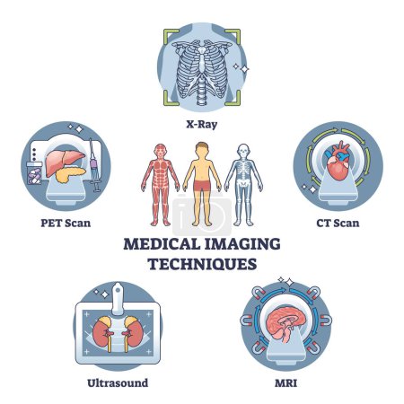 Illustration for Medical imaging techniques for medical body diagnostics outline diagram. Labeled educational scheme with types for bones or organs inner examination vector illustration. X-ray, CT scan or MRI record. - Royalty Free Image