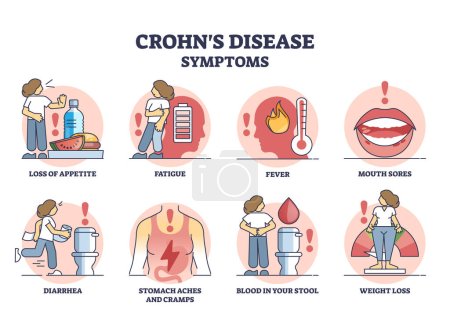Morbus Crohn Symptome einer entzündlichen Darmerkrankung umreißen Diagramm. Beschriftete medizinische Liste von Problemen aufgrund von Entzündungsvektoren im Verdauungstrakt. Schmerzen und Durchfall verursachen.