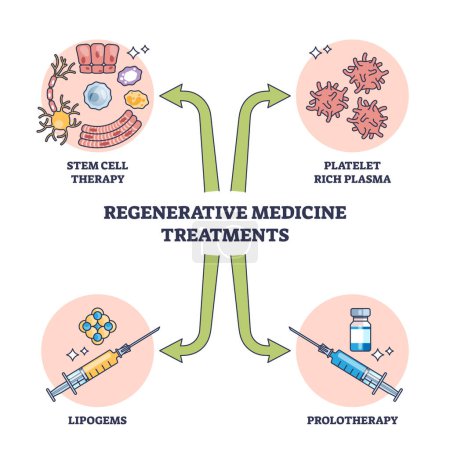 Illustration for Regenerative medicine treatment methods for patient cure outline diagram. Labeled list with stem cell, platelet rich plasma, lipogems and prolotherapy injection for health therapy vector illustration - Royalty Free Image