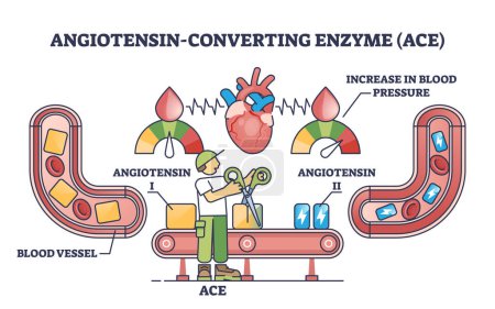 Angiotensin Umwandlung von Enzym oder ACE in Blutgefäße Gesundheitsskizze. Beschriftetes medizinisches Bildungsschema mit kardiologischer Behandlung für erhöhte Blutdruckproblematik.
