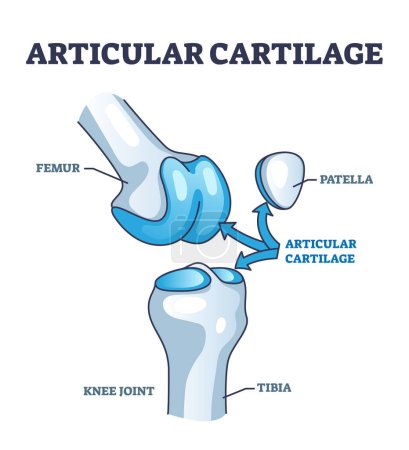 Illustration for Articular cartilage structure and location in knee joint outline diagram. Labeled educational scheme with femur, tibia and patella parts vector illustration. Healthy leg skeleton movement explanation - Royalty Free Image