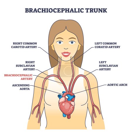 Illustration for Brachiocephalic trunk anatomy with innominate blood artery outline diagram. Labeled educational medical scheme with blood flow cycle and first branch of human aortic arch vector illustration. - Royalty Free Image