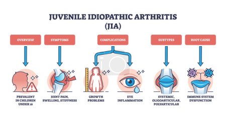 Illustration for Juvenile idiopathic arthritis or JIA ad children disease outline diagram. Labeled educational scheme with medical condition for kids with joint pain, swelling and stiffness vector illustration. - Royalty Free Image