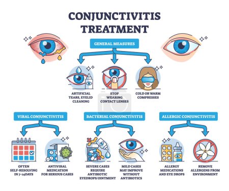 Conjunctivitis treatment with medicines and medical help outline diagram. Labeled educational scheme with simple care recommendations for viral, bacterial and allergic infection vector illustration.