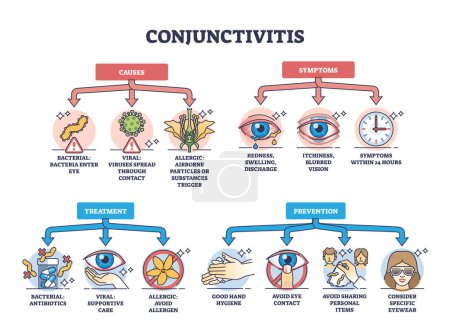 Illustration for Conjunctivitis or pink eye causes, symptoms, prevention and treatment outline diagram. Labeled educational scheme with eyes inflammation and medical condition explanation vector illustration. - Royalty Free Image