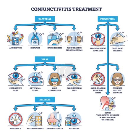 Illustration for Conjunctivitis treatment for bacterial, viral and allergic illness types outline diagram. Labeled educational prevention and medical recommendations for pink eye syndrome care vector illustration. - Royalty Free Image