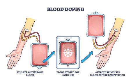 Illustration for Blood doping principle with athlete reinfusion for strength and power outline diagram. Labeled educational scheme with cheating process to illegally inject blood before competition. Performance boost - Royalty Free Image