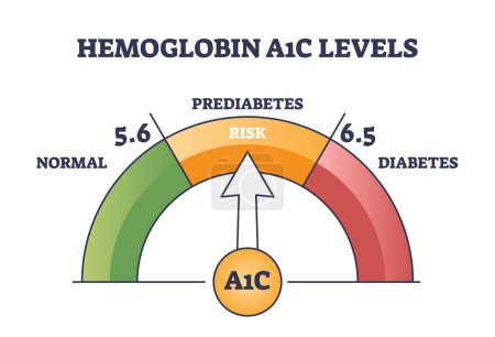 Illustration for Hemoglobin A1C test for prediabetes and diabetes checkup outline diagram. Labeled educational scheme with bloodstream glucose level measurement vector illustration. Sugar control, monitoring in blood - Royalty Free Image