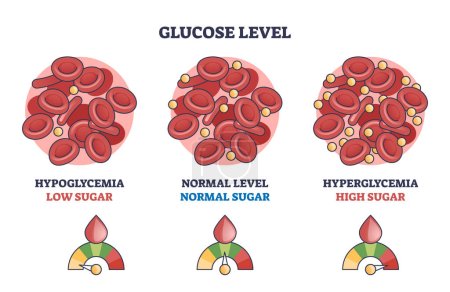 Illustration for Glucose level with low, normal and high sugar in blood outline diagram. Labeled educational scheme with hypoglycemia and hyperglycemia problem monitoring vector illustration. Cardiovascular health. - Royalty Free Image