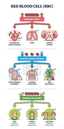 Illustration for Red blood cell count with low and high and normal levels outline diagram. Labeled educational scheme with abnormal RBC test results with possible causes vector illustration. Hematological diseases. - Royalty Free Image