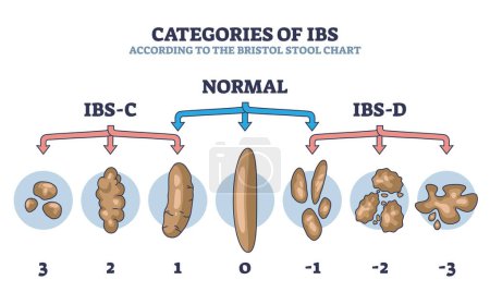 Kategorien von IBS-Stufen nach der Skizze des Borstollhockerschemas. Beschriebenes Bildungsschema mit normalen und abnormalen Exkrementsstrukturen als Vektorillustration. Verdauungsbeschwerden.