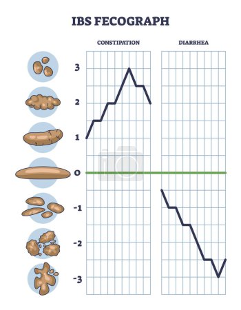 El fecograma del SII como taburete diario de bristol forma el diagrama del contorno de la representación. Esquema educativo etiquetado con diagnóstico de estreñimiento o diarrea a partir de la ilustración del vector de clasificación de excrementos del paciente.