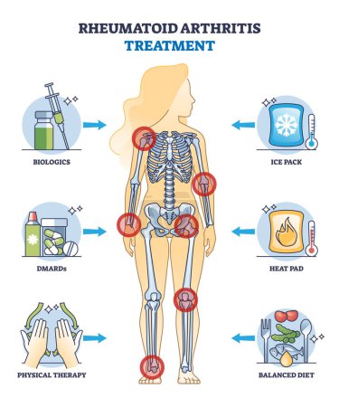Behandlung der rheumatoiden Arthritis und Methoden der Gesundheitstherapie skizzieren das Diagramm. Etikettiertes Bildungsschema mit Biologie, DMARD-Therapie und ausgewogener Ernährung zur Abbildung chronischer Schmerzvektoren.