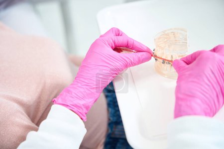 Der Arzt arbeitet mit einem Modell des Gebisses mit Zahnspangen und orangefarbenen Verbrauchsmaterialien, der Spezialist verwendet rosa Handschuhe