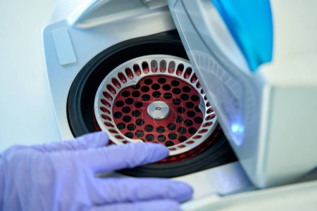Téléchargez les photos : Hematologist in a protective glove removes a cartridge from a laboratory centrifuge, this is a modern diagnostic equipment - en image libre de droit
