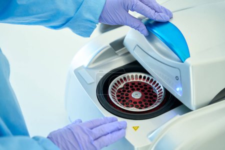 Téléchargez les photos : Assistant de laboratoire hématologue dans un gant de protection fonctionne avec une centrifugeuse hématologique, c'est un équipement de diagnostic moderne - en image libre de droit