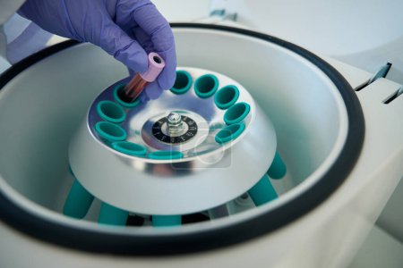 Foto de Laboratory assistant in a clinical laboratory puts a test tube with red liquid into a hematological centrifuge - Imagen libre de derechos