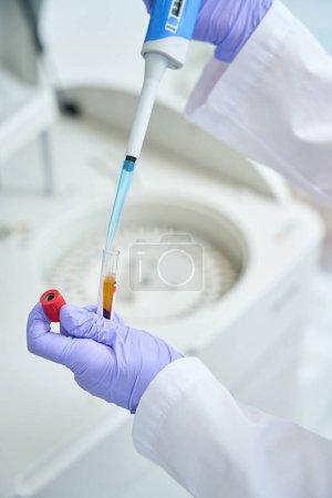 Foto de Laboratory employee prepares a biomaterial for loading into a biochemical analyzer, the equipment is in the testing unit - Imagen libre de derechos