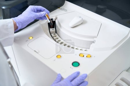 Foto de Laboratory employee sends a blood sample to an immunochemiluminescent analyzer, this is a modern diagnostic device - Imagen libre de derechos