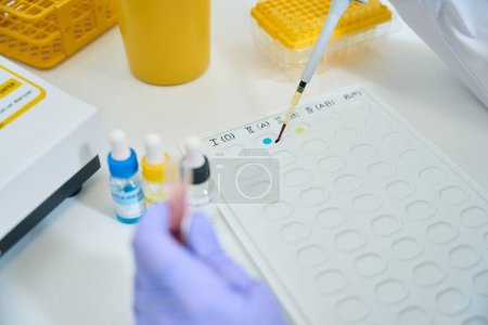 Foto de Worker in a chemical laboratory conducts a blood type test, he uses special reagents - Imagen libre de derechos